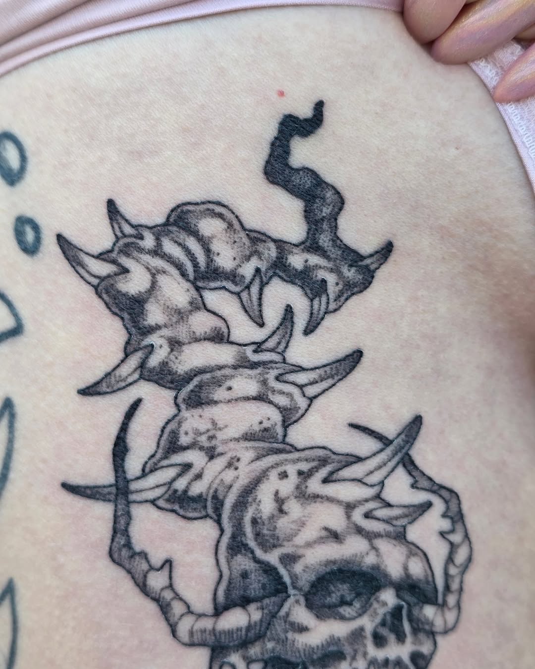 urchinbite