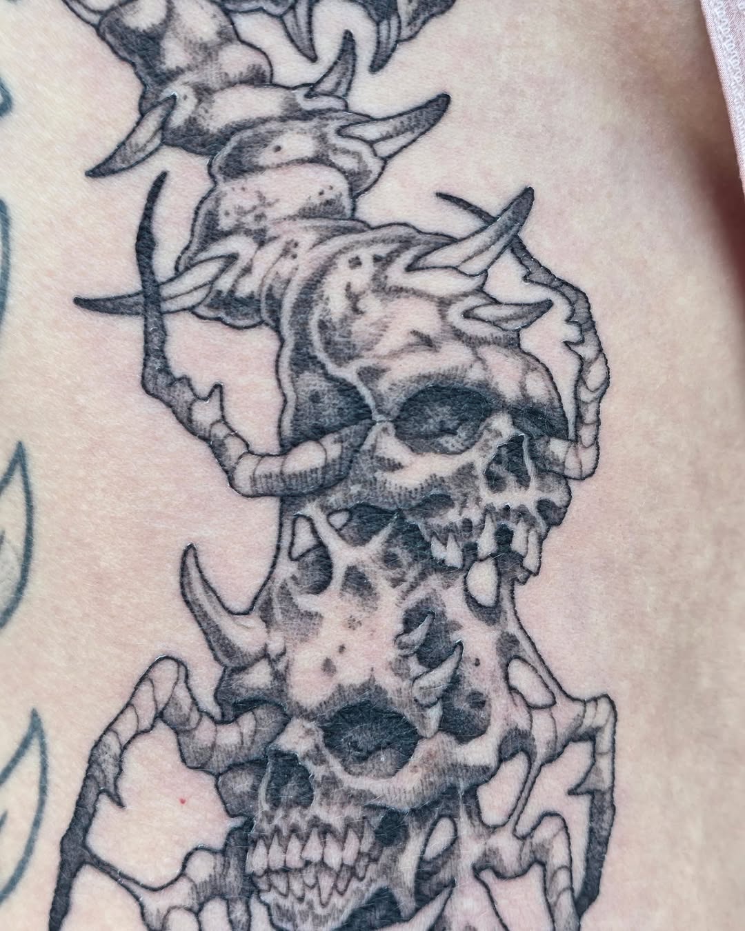 urchinbite