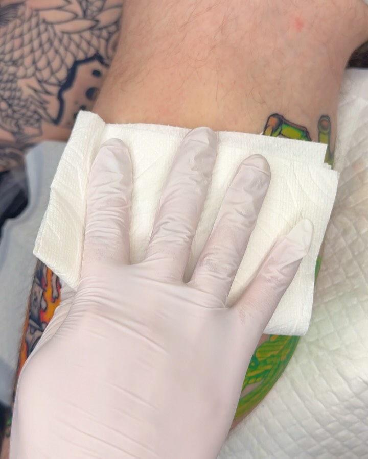 yoonneedle