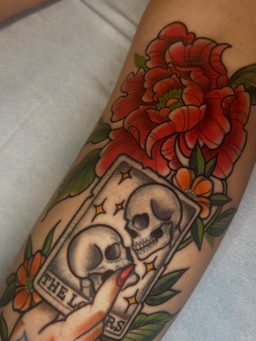sarastigmata