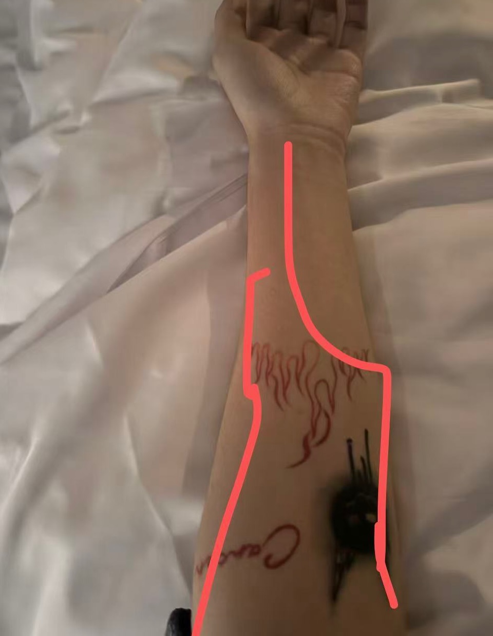 5.kaat