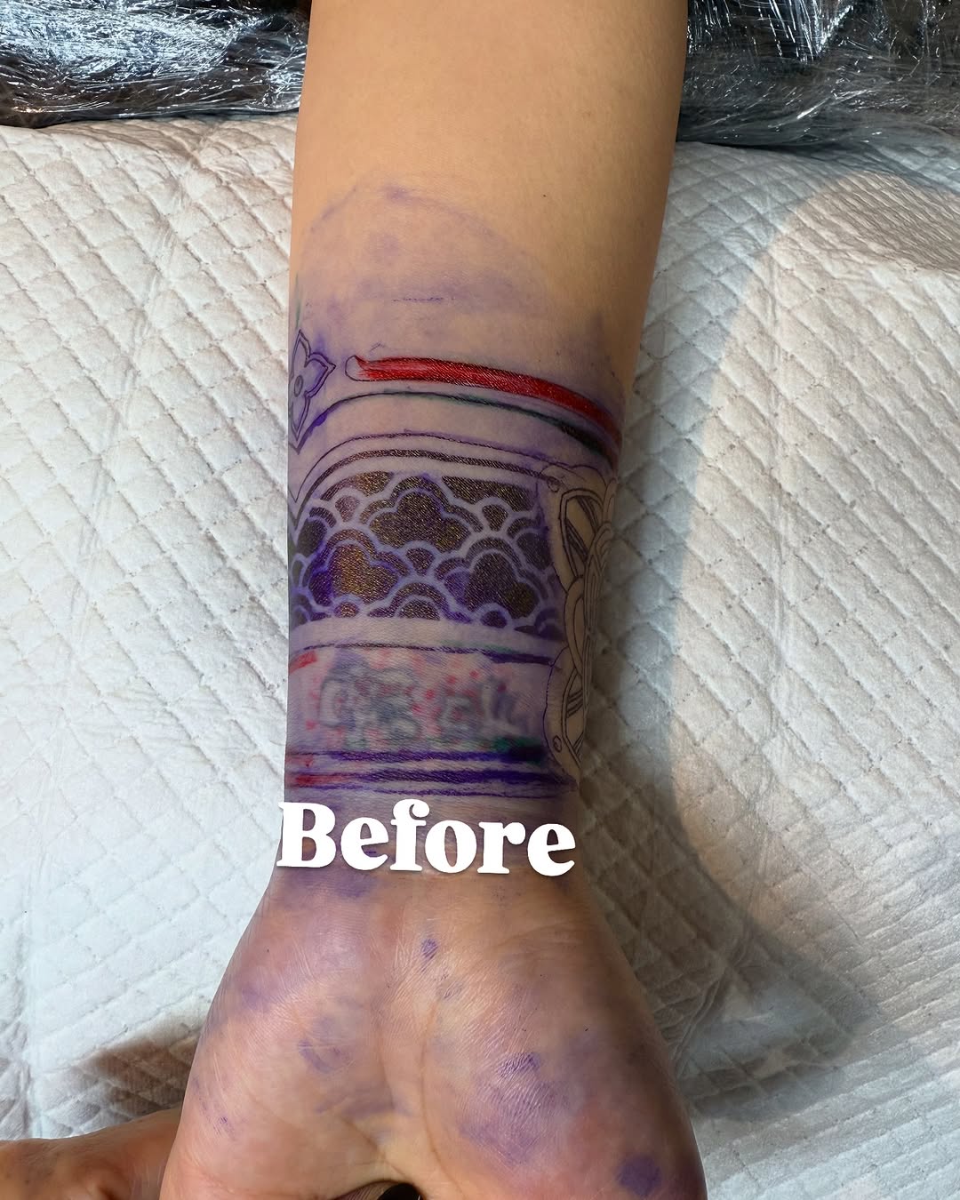 micotattoo