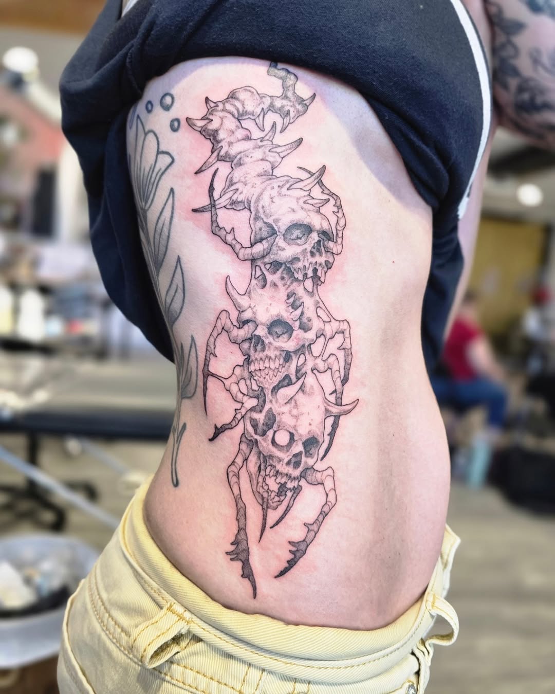 urchinbite